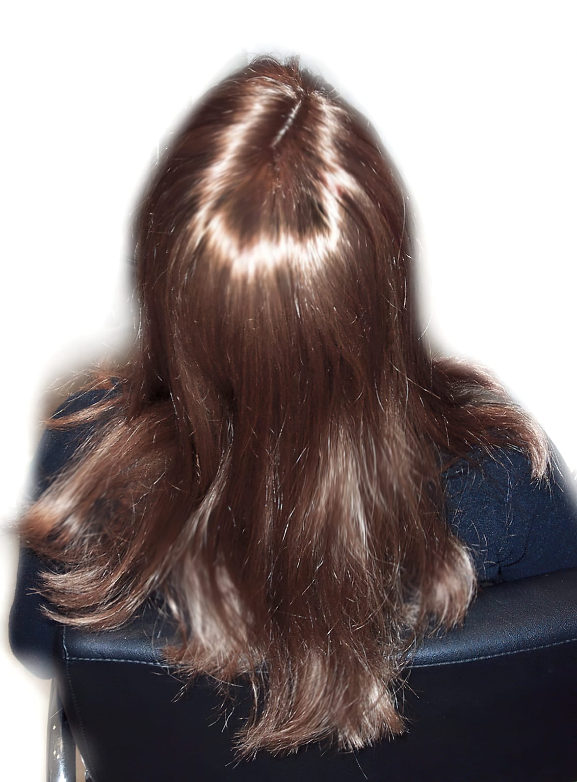 After Picture - Androgenetic Alopecia Cosmetic Cover-Up